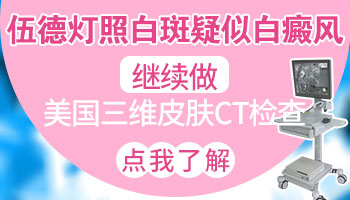 腿上皮肤一块一块白斑图片